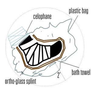 towel-bag-sphere